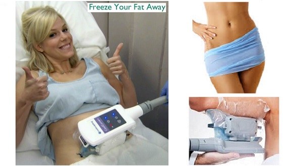 fat freezing treatment